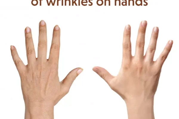 The Ultimate Guide to How to Get Rid of Wrinkles on Hands Naturally